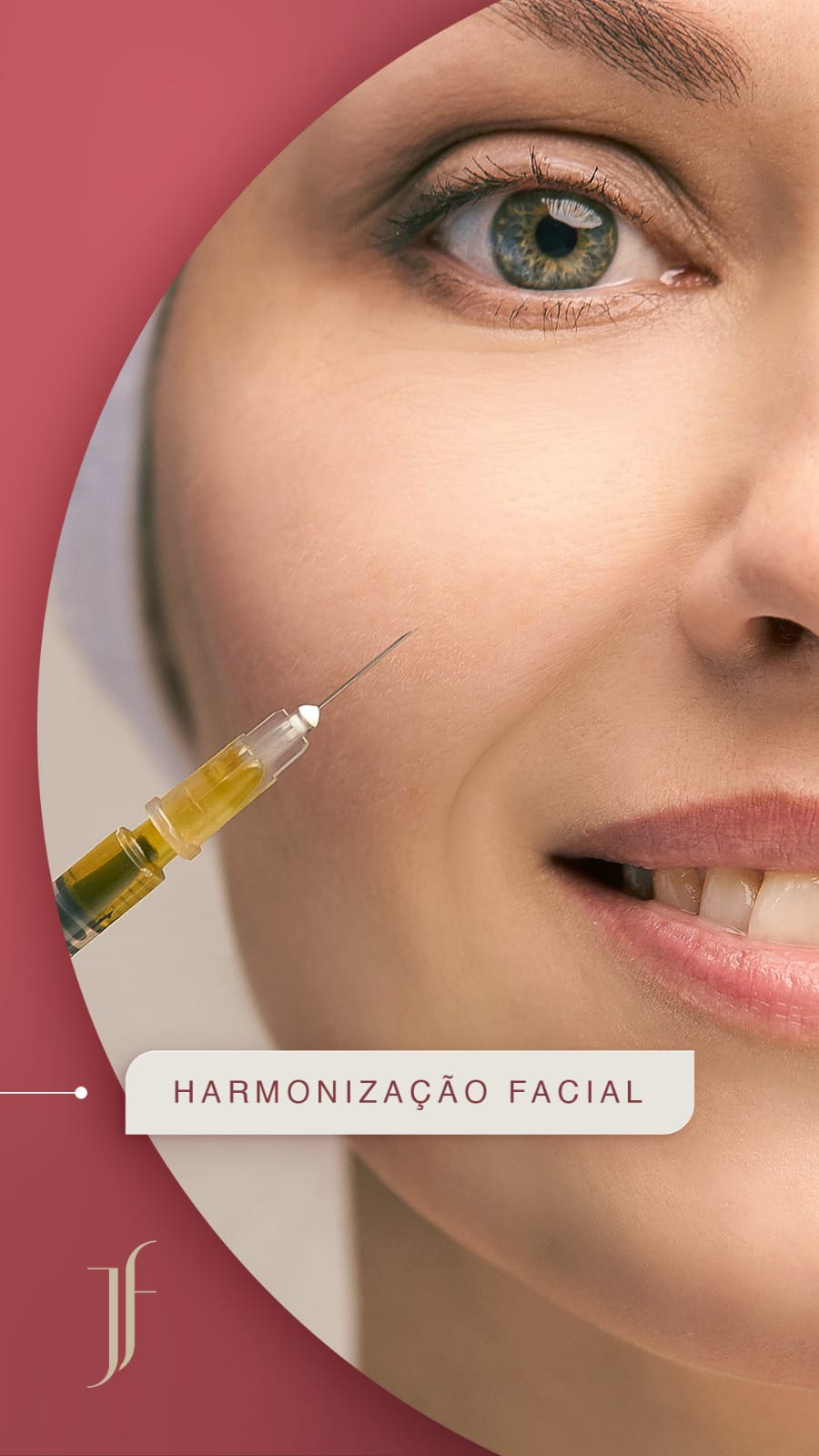 Harmonização Facial